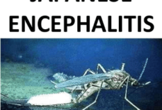 Japanese Encephalitis