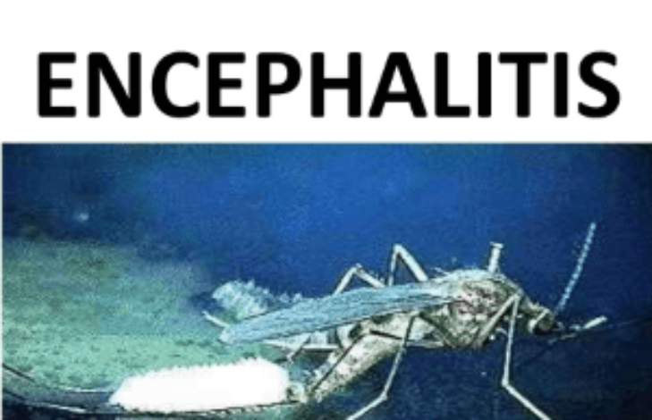 Japanese Encephalitis